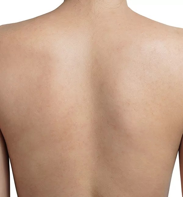 After-bodytwo